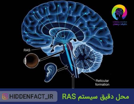سیستم RAS چیست ؟