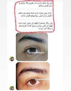 پکیج کامل زیبایی (2025) مگاسونیک و قدرتمند – یکبار برای همیشه