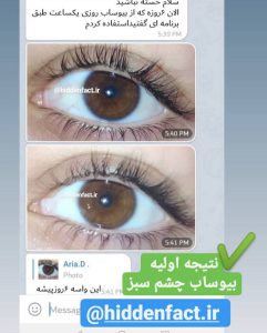 پکیج کامل زیبایی (2025) مگاسونیک و قدرتمند – یکبار برای همیشه